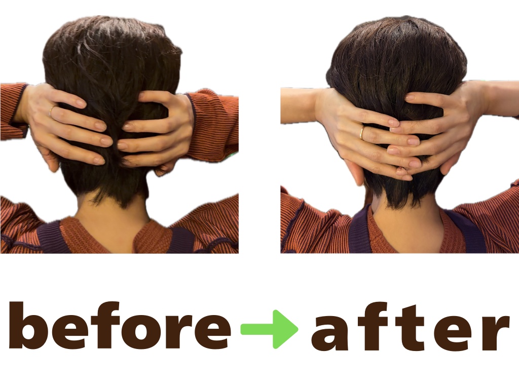 Before After｜頭の大きさ・後頭部の張りの変化